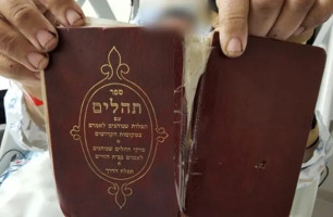 The Book of Psalms held by the bombing victim, which prevented a shard of debris from piercing his body. (Photo: Shaare Zedek Medical Center)